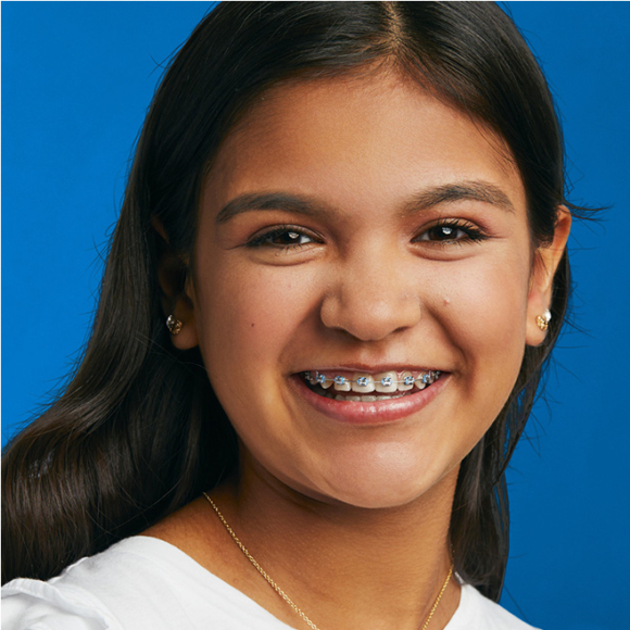 Braces in Stillwater Metal & Invisible Braces for All Ages